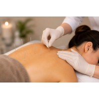 Acupressure Dry Needling Therapy